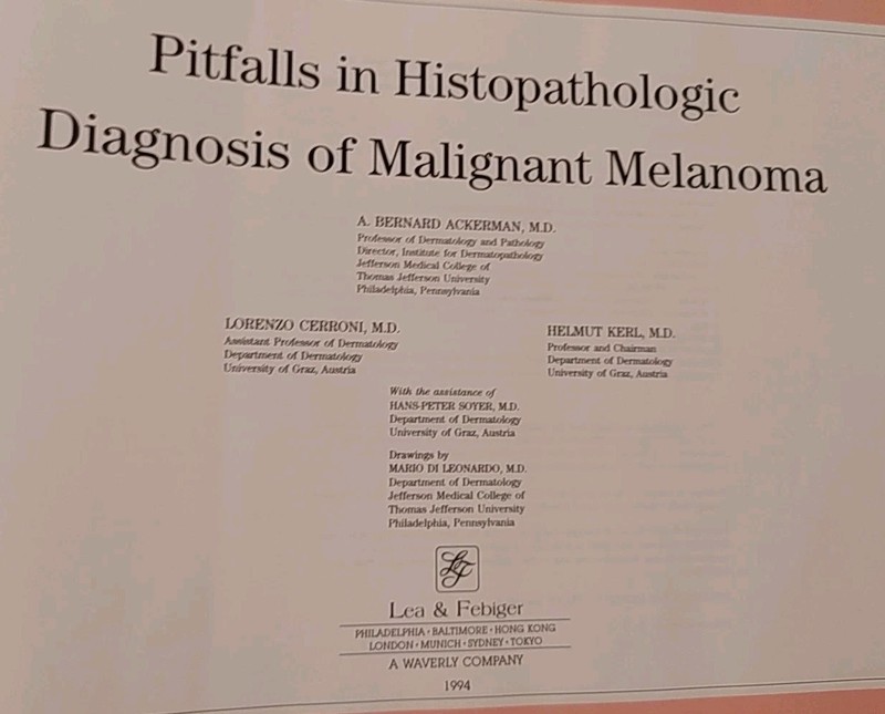 Pitfalls in Histopathologic Diagnosis of Malignant Melanoma A B Ackerman gallery