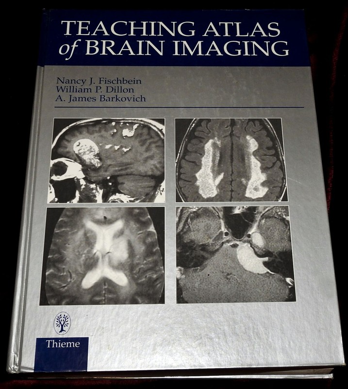 Teaching Atlas Ser.: Teaching Atlas of Brain Imaging by William P. Dillon, Nancy