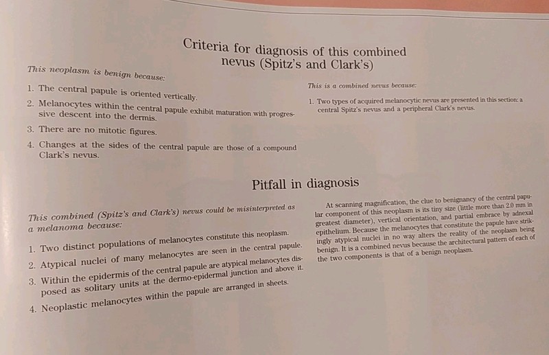 Pitfalls in Histopathologic Diagnosis of Malignant Melanoma A B Ackerman gallery